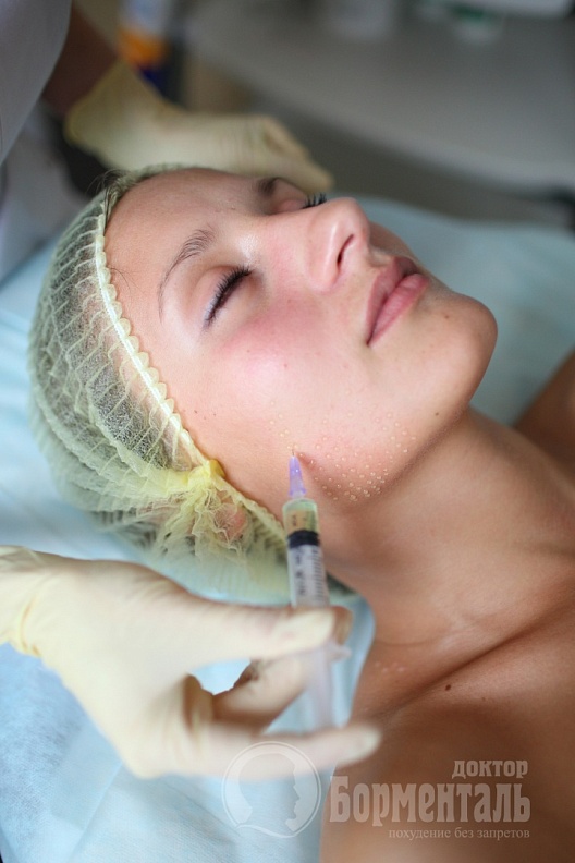 Мезотерапия Мезотерапия